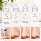 ✨ Pore Vacuum Blackhead Remover - GIMZ